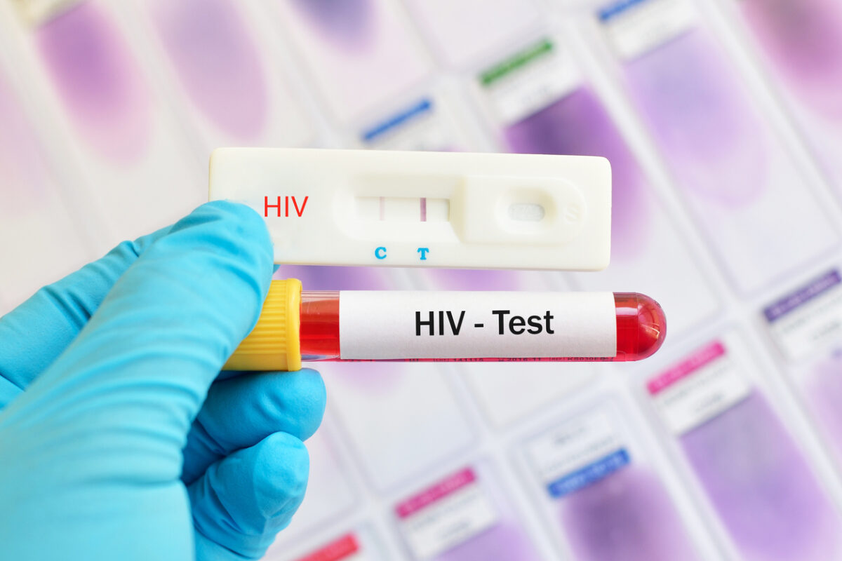 how-to-read-std-test-results-std-free-los-angeles